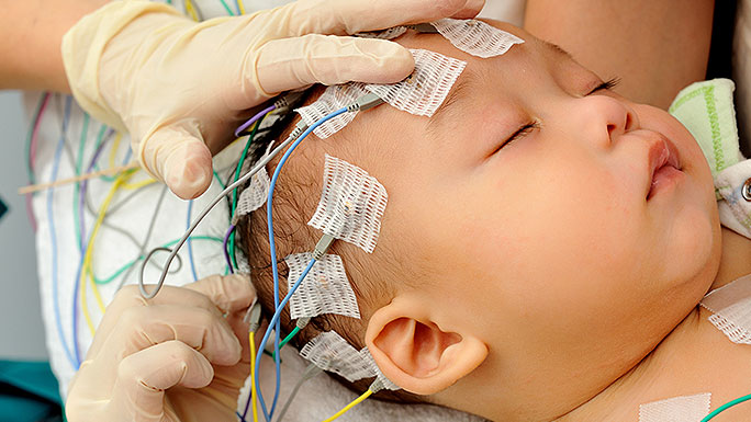 https://batrahealthcare.com/wp-content/uploads/2023/12/eeg-electrodes-baby.jpg