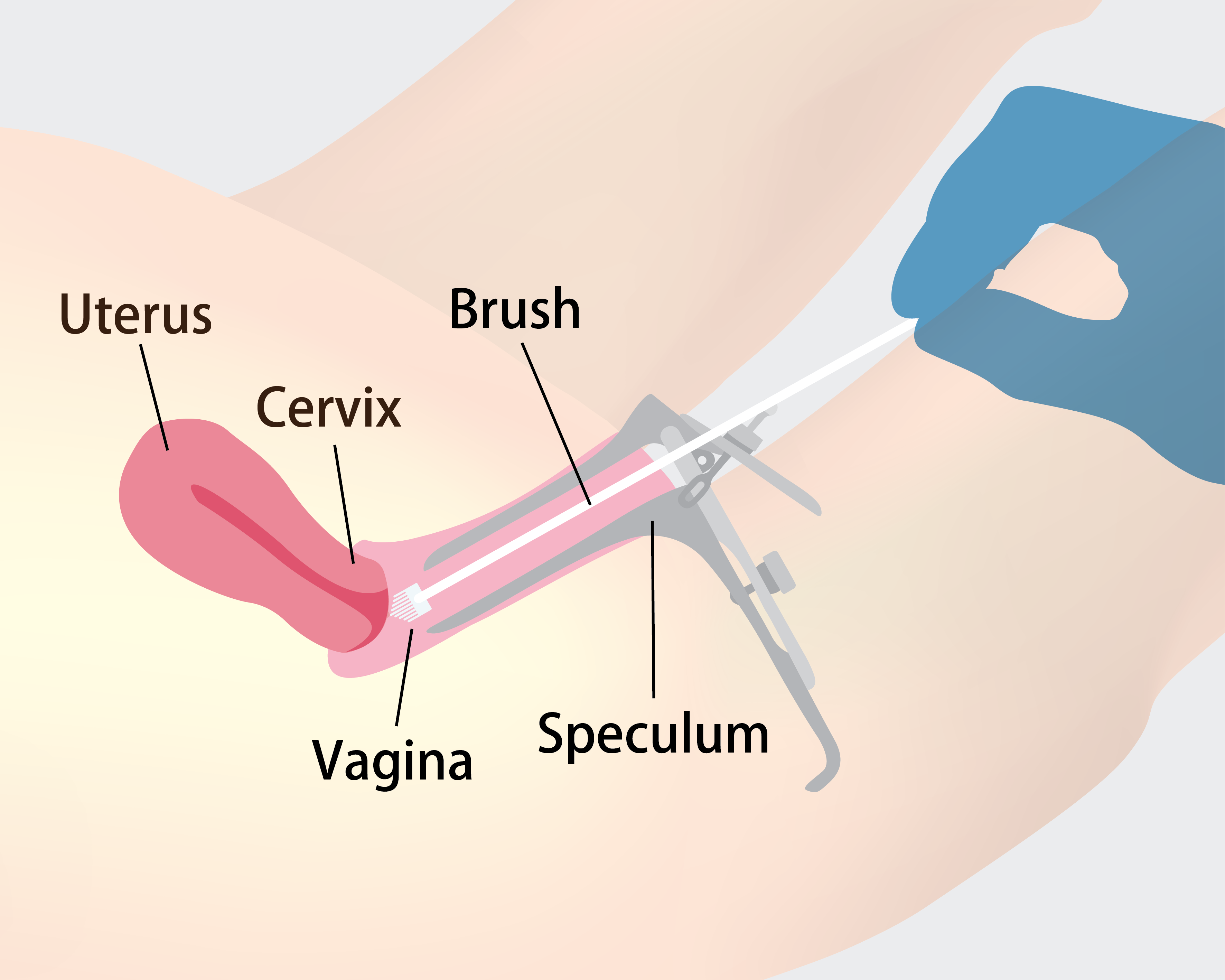 https://batrahealthcare.com/wp-content/uploads/2024/03/how_cervical_screening_is_done_2.png